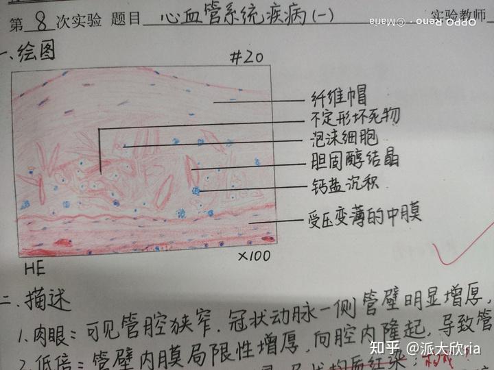 病理学实验报告红蓝铅笔手绘图有老师批改