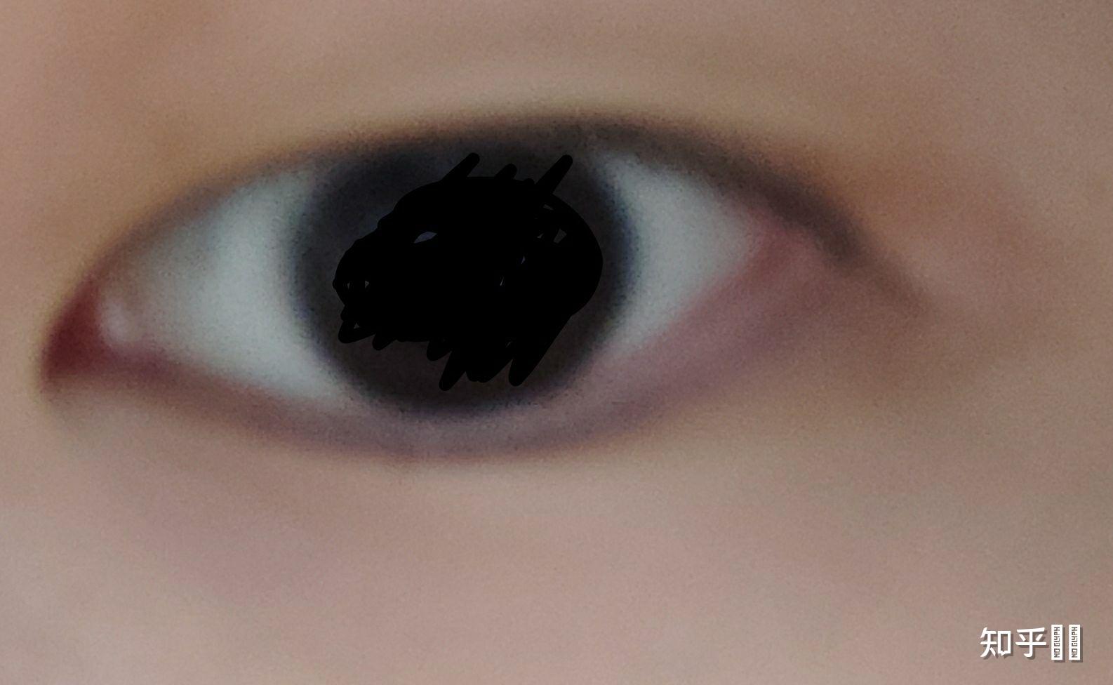 怎么测眼型