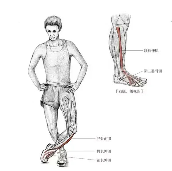 小腿疼痛 ),脚踝扭伤 ,腓骨肌腱脱位 , 腓骨肌肌腱炎
