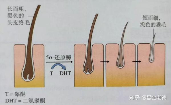 脱发后当我们谈毛囊检测时,我们在检测什么?