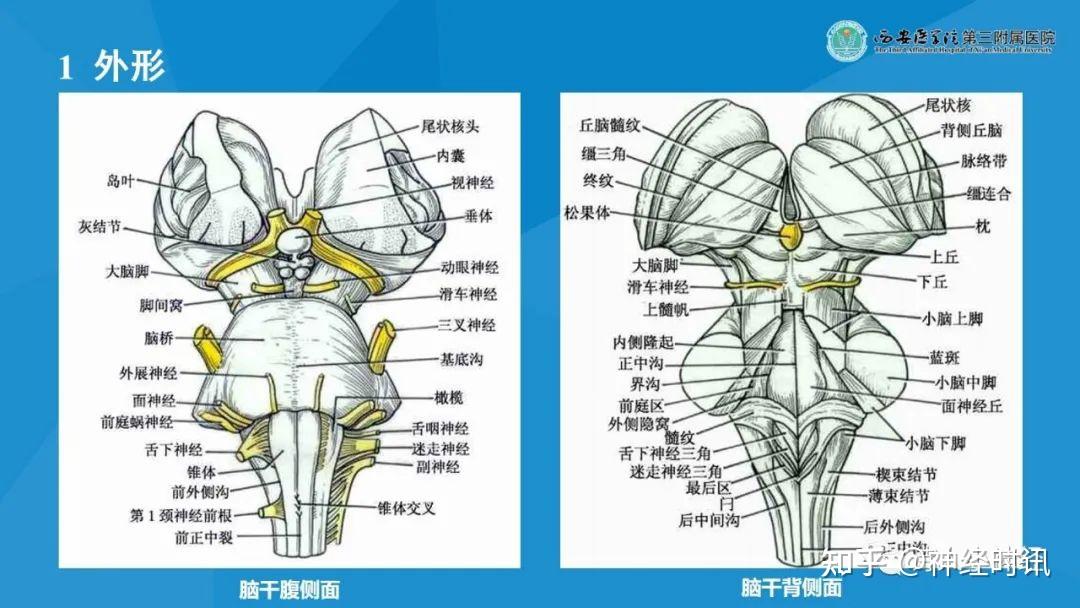 临床笔记脑干解剖及损害表现