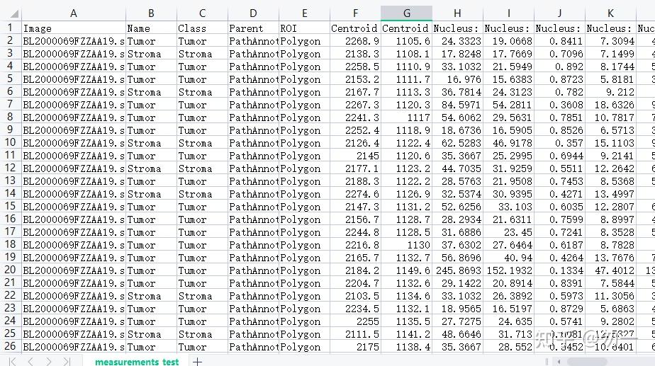 查看细胞属性>点击measure>showdetectionmeasurements按钮,查看当前