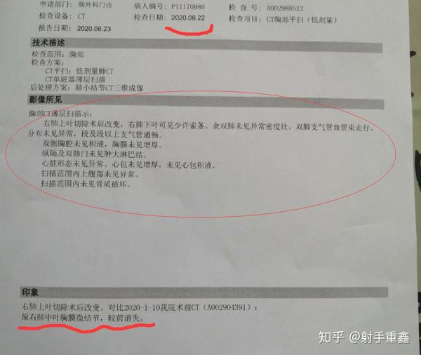 肺结节良性硬化性肺细胞瘤术后第一次ct结果