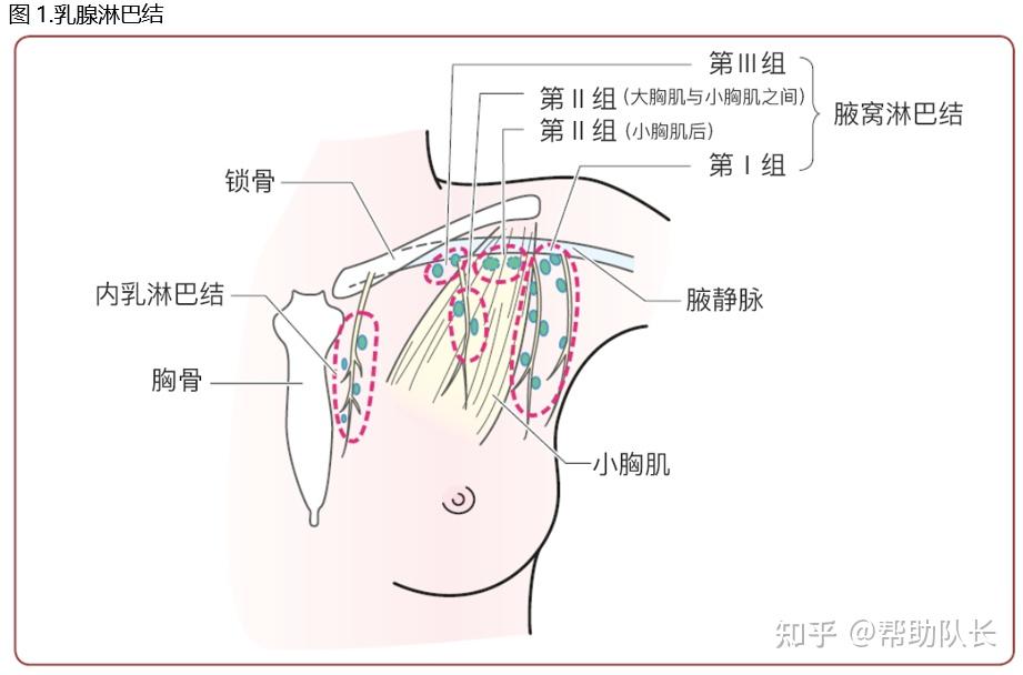 以前通常采用将第Ⅰ至Ⅲ组淋巴结全部切除的方法,有时还进行锁骨上