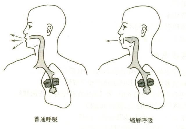 缩唇呼吸操作方法示意图