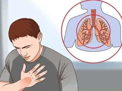 肺癌术后咳嗽,如何有效止咳平喘?1个中医消瘤抗癌方,帮你搞定