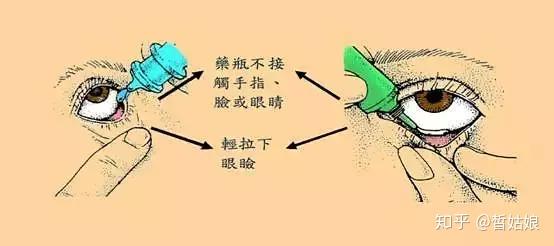 教你正确地滴用眼药水