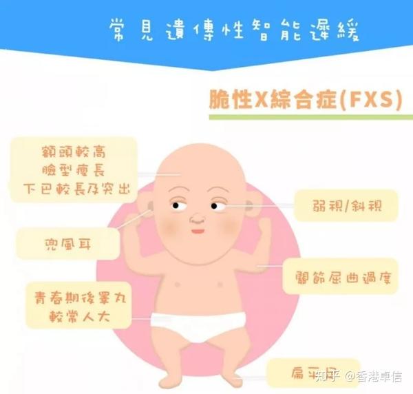 为什么男宝宝会更容易患脆性x综合症?