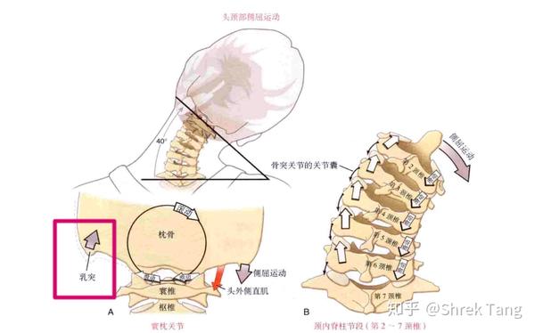 通过乳突左右的高低判读是否侧倾;乳突前后判断是否有旋转(上文不是