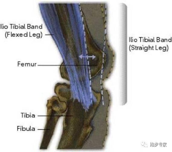 面对髂胫束症候群,别再盲目放松大腿外侧