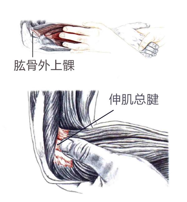 肘关节表示很受伤!