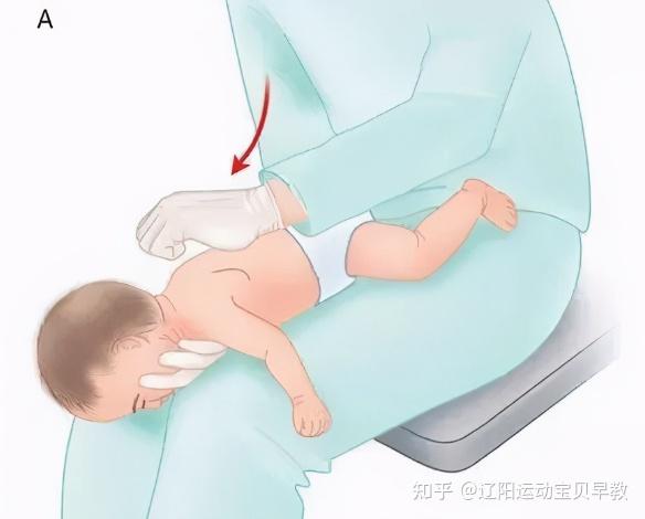 宝宝呛奶怎么办,教你3招正确做法