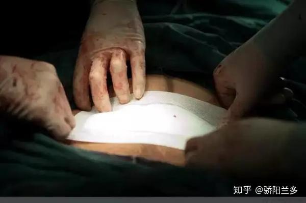生孩子都不是一件容易的事,过程中都会有风险,是在拿命爱一个男人,爱