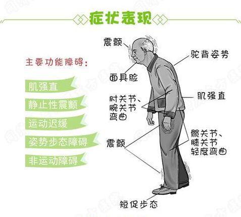 没想到如此常见的表现竟然可能是帕金森病前兆