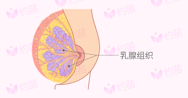 摸到胸部有硬块,难道是乳腺癌?