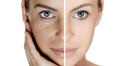皮肤暗沉泛黄肤色不均如何用医学护肤来进行改善