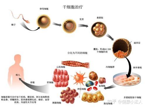 (1)与异基因干细胞移植比较:自体外周血干细胞移植不受