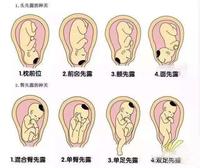 育儿说:怀孕是几个月可以定胎位?别不在意