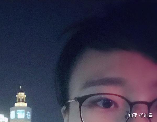 ps,我不是丹凤眼,我应该是内双吊梢眼,看到好多强答的,我想来给大家