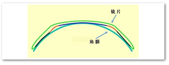 深蓝色和红色弧段代表镜片的后表面,再下方紧贴着的是角膜