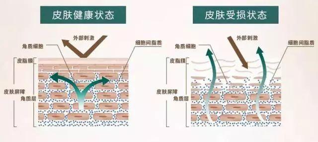 瘙痒致皮肤的搔抓,可使皮肤屏障功能受损,导致皮肤水分丢失,皮肤干燥