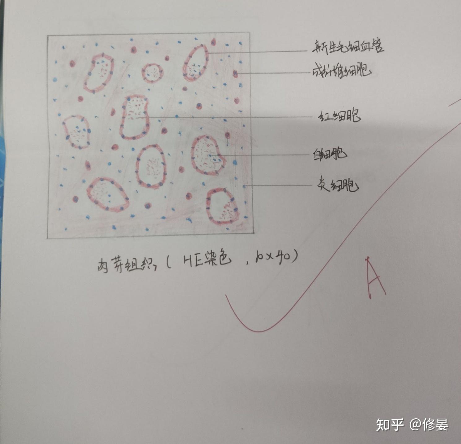 病理切片红蓝铅笔绘图