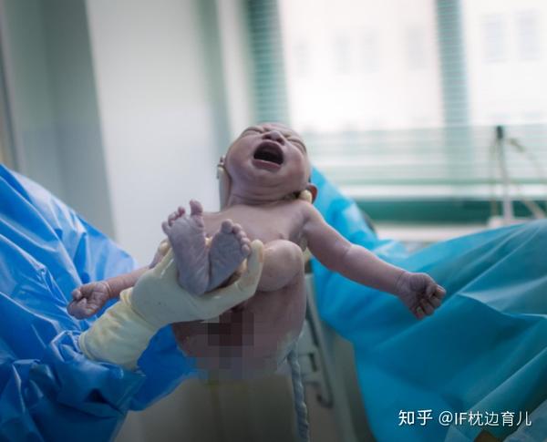 产妇顺产时,婴儿被一把拽出来,是一种怎样的体验?