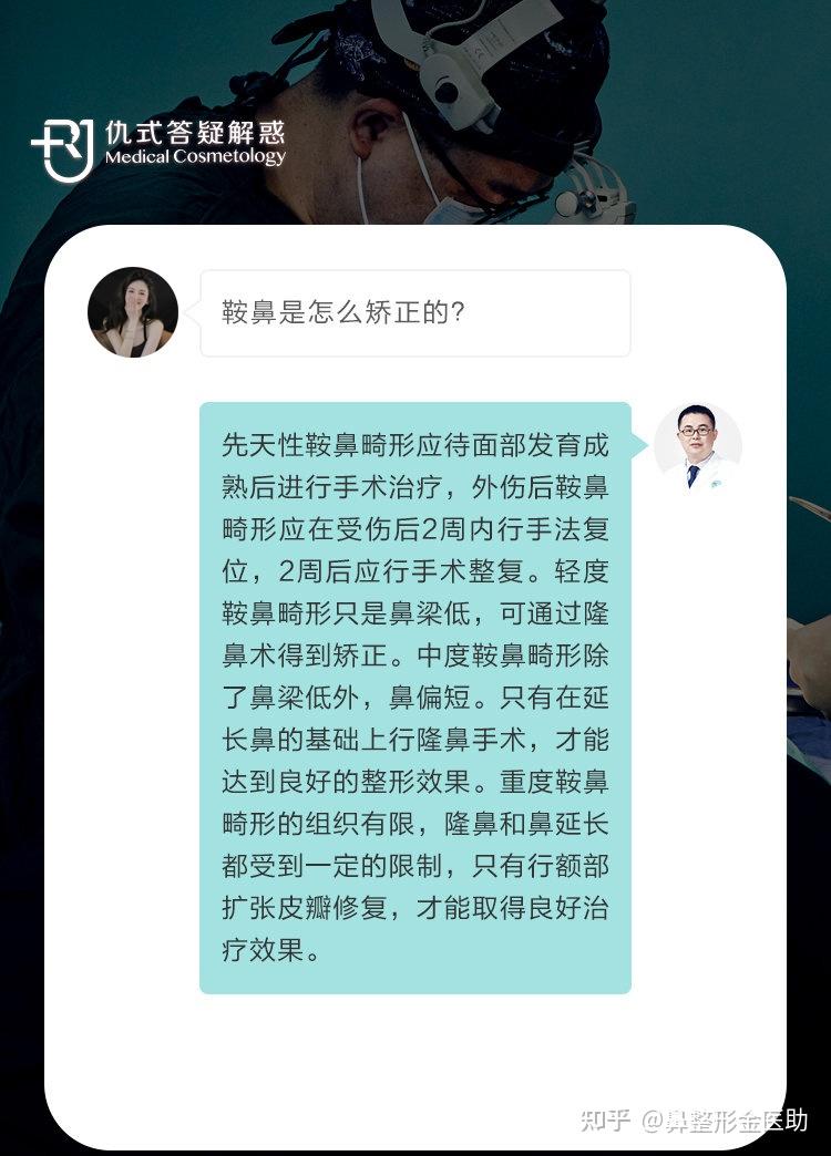 这种鼻子属不属于鞍鼻