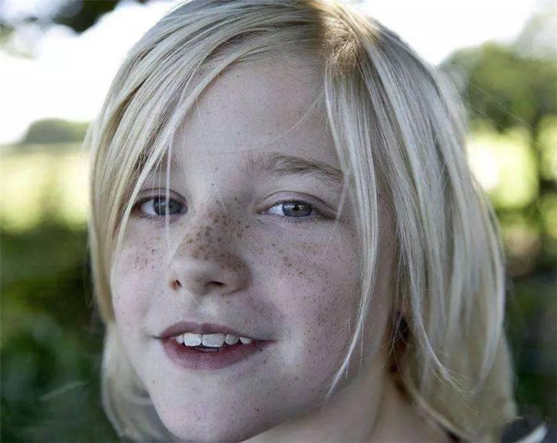 雀斑影响运势吗 脸上有雀斑的女人面相