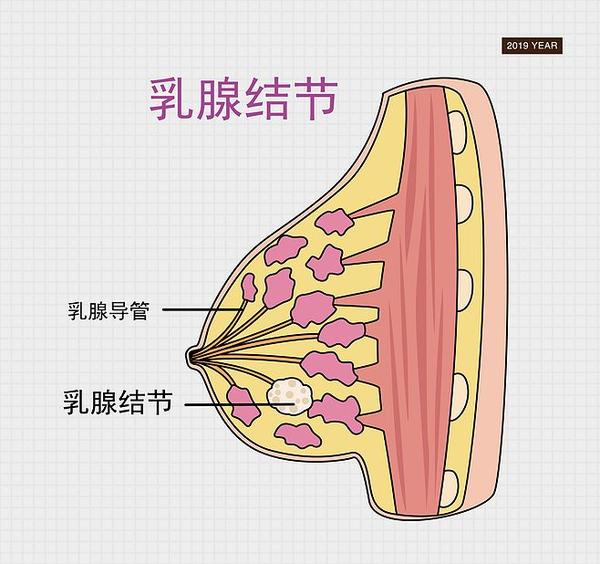 乳腺癌是女性第一杀手预防它这4个方法试一试