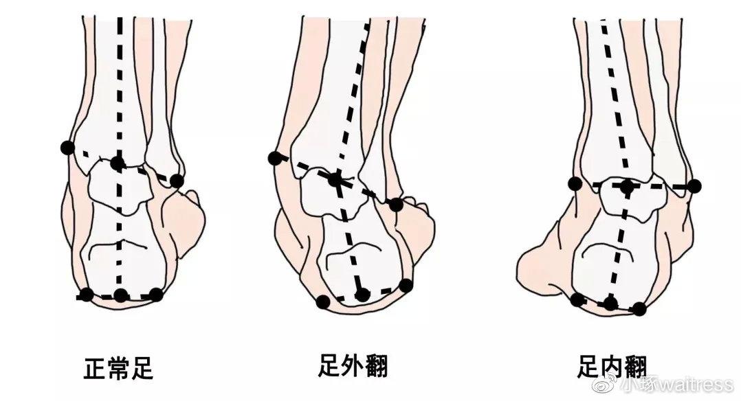 三步教你学会自查足踝问题原来脚的秘密在这济南小琢运动康复