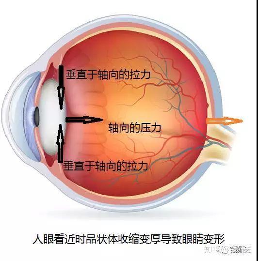 近视了,关于眼轴的知识你知道多少?