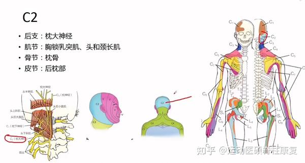颈突神经卡压疼痛部位分析
