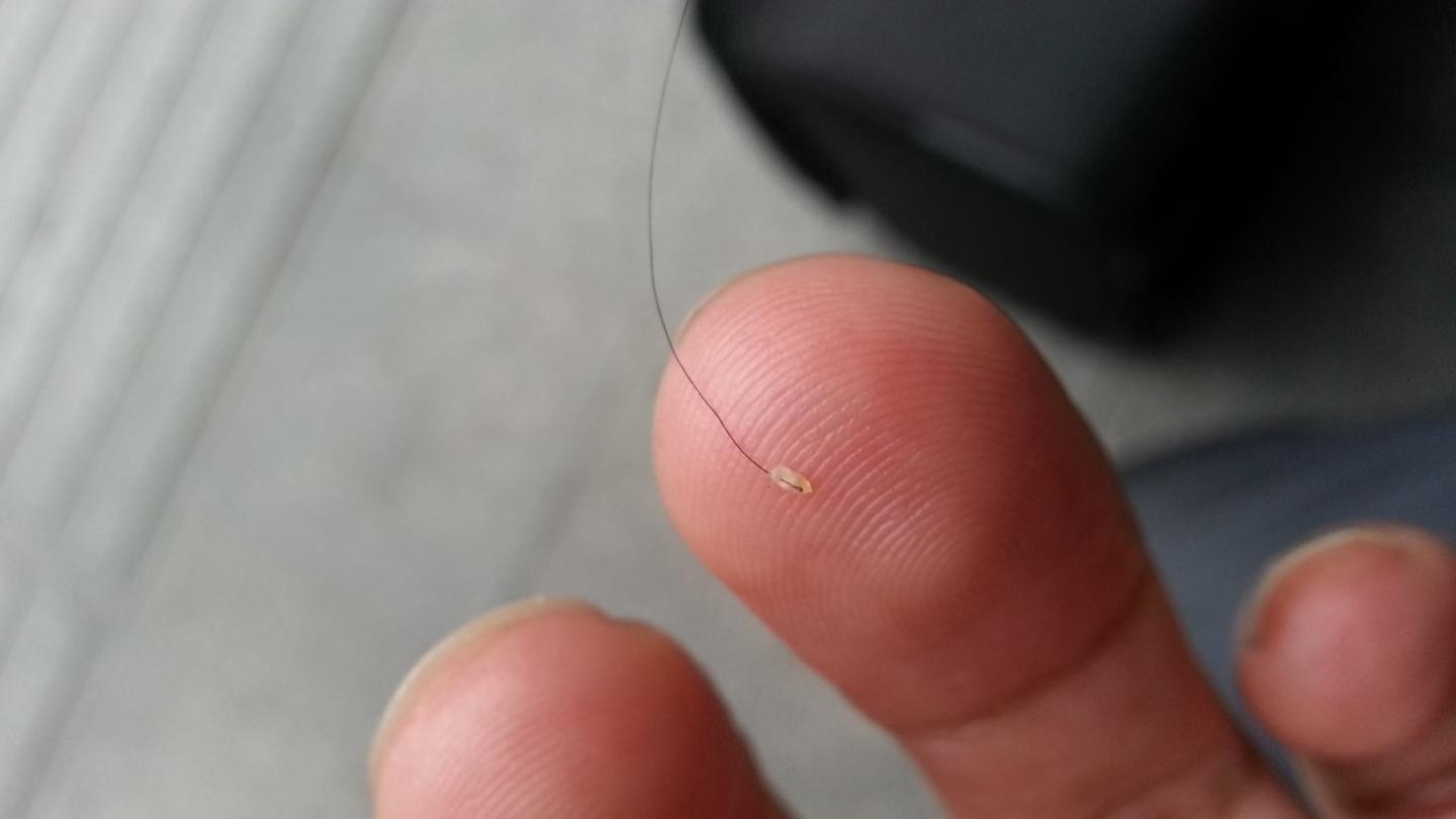 脱发再生发根很浅容易掉发根很油怎么办