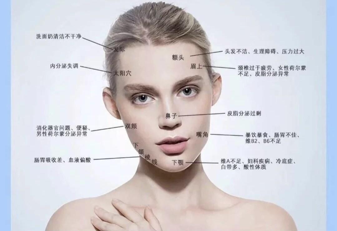 爆痘烂脸的原因综合分析来看,是比较复杂的.