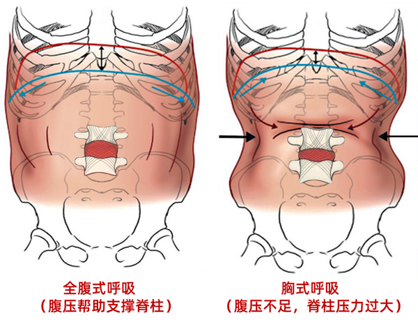 膈肌除了呼吸,还有建立腹内压,帮助支撑脊柱的功能,而胸式呼吸的模式