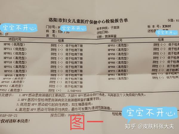 洛阳市梁女士hpv52型高危转阴病例分享