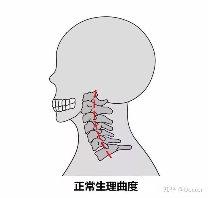 维持人体直立和躯干平衡,颈椎呈向前凸出的弧度,如果没有这个颈椎前凸