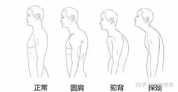 圆肩驼背干货沉肩夹背怎么做