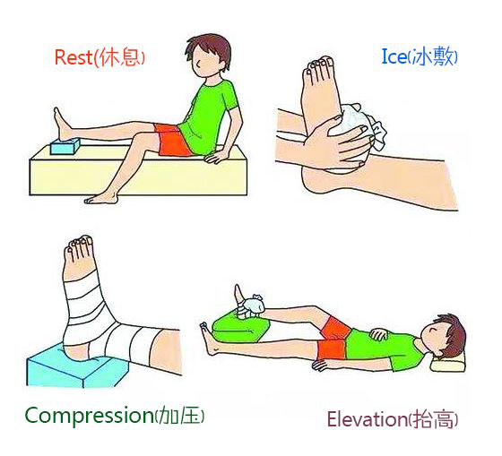 不小心把脚踝扭伤了怎么办?足卫士为您支招!