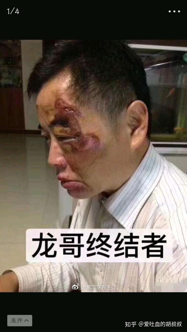 如何看待昆山震川路龙哥砍人被反杀事件?被砍男子行为算正当防卫吗?