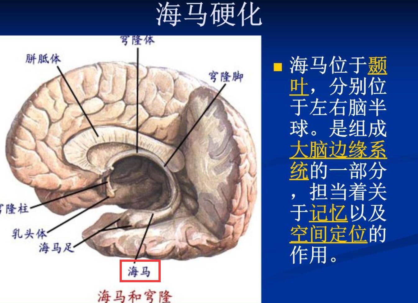 张光明:颞叶是功能非常复杂的脑叶,因此颞叶癫痫也成为常见的发作类型