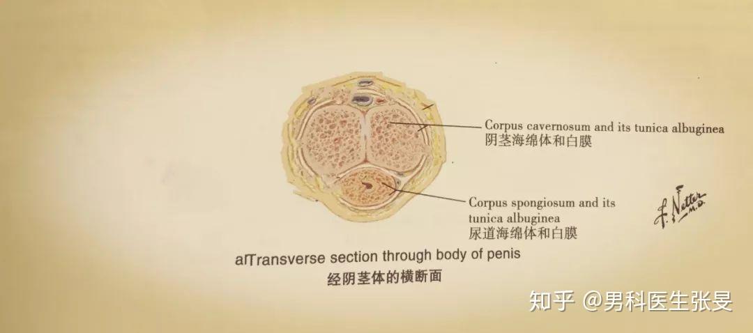 此时极易受垂直外力,甚至是轻微外力作用下导致白膜及海绵体破裂