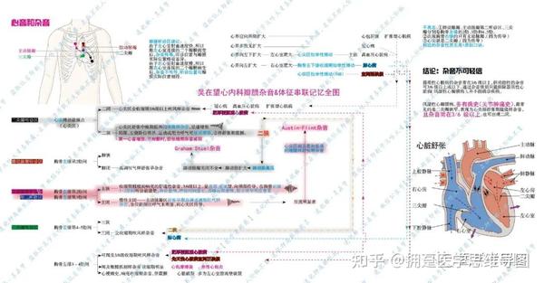 心肌病速记思维导图——肥厚梗阻性心肌病思维导图