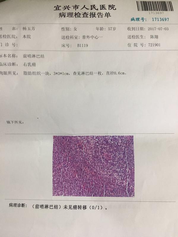 浸润性导管癌部分导管原位癌是否需要靶向治疗