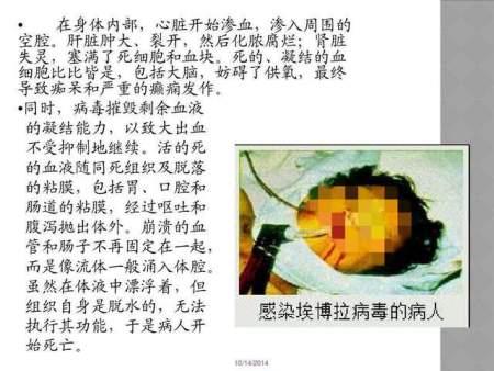 比新冠病毒还厉害,科学家束手无策,埃博拉到底有多恐怖?