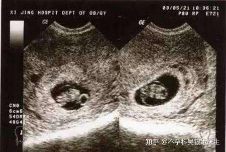 不会测排卵期?四大方法助你轻松监测!
