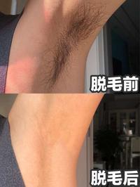 真的好用到哭～ 下面先给大家介绍一下我的脱毛过程吧: 1