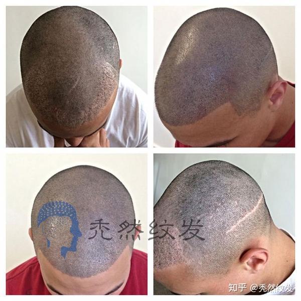 纹发一年效果图就知道答案!