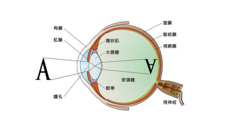 简单一句话,近视是由于晶状体变形无法恢复导致的.